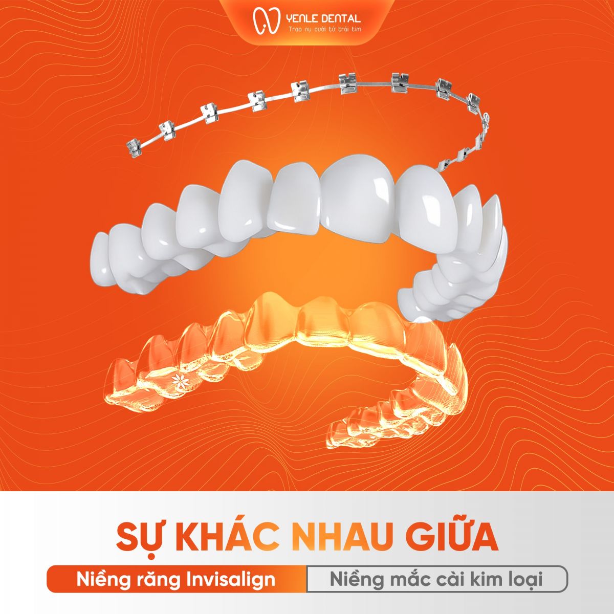 Niềng răng invisalign